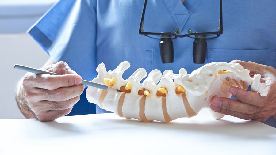 riwospine-lumbar-stenosis-anatomy-model-education.png Doctor demonstrating lumbar spinal stenosis on anatomical model – minimally invasive treatment education