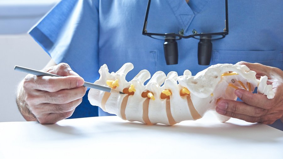 riwospine-lumbale-stenose-anatomiemodell-aufklaerung.png Arzt erklärt lumbale Spinalkanalstenose mit Modell – minimalinvasive Behandlungsaufklärung