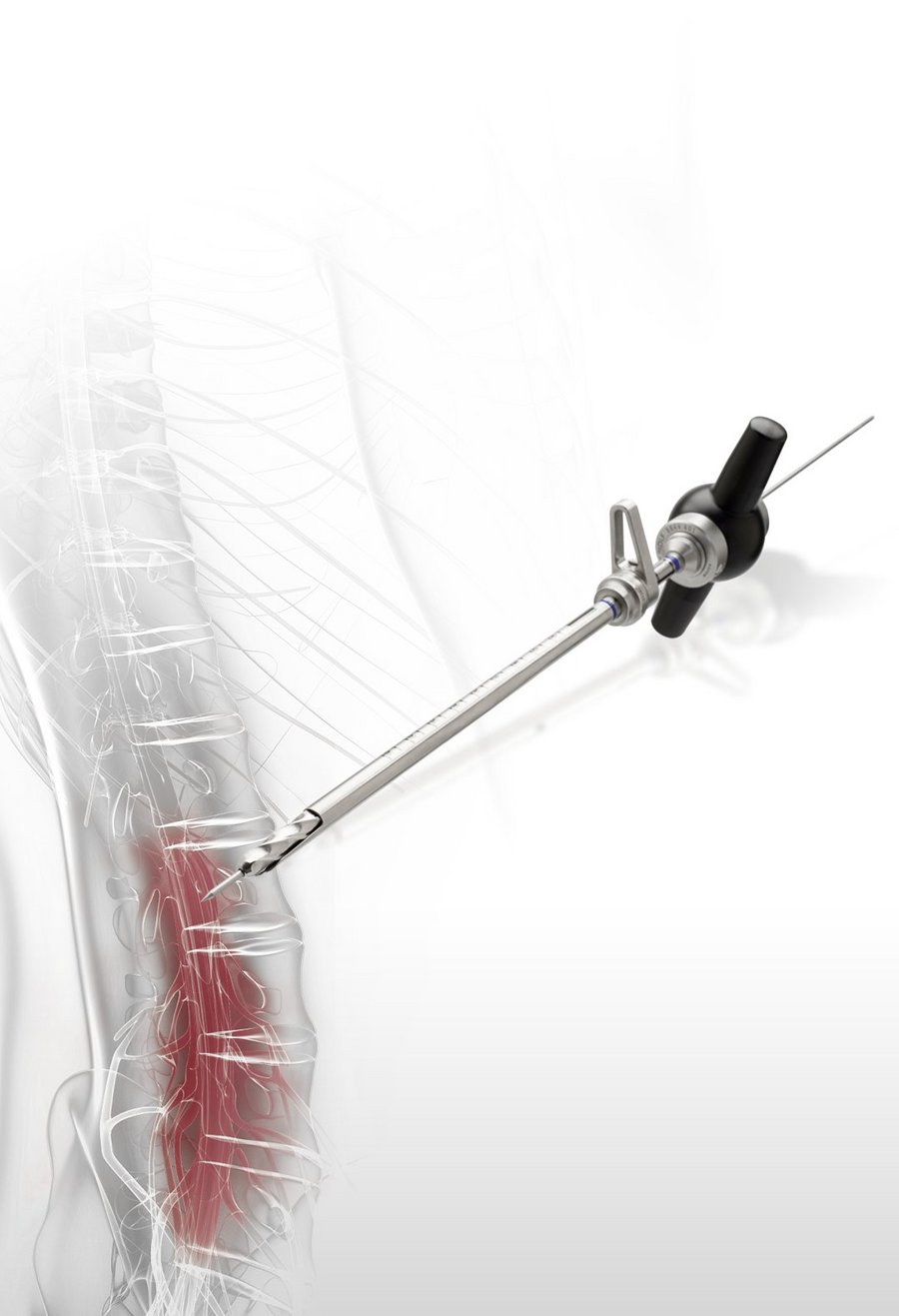 riwospine-vertebris-foraminotomie-manuelles-bohrsystem.png VERTEBRIS-Foraminotomie manuelles Bohrsystem mit ergonomischem Design und Nervenschutz