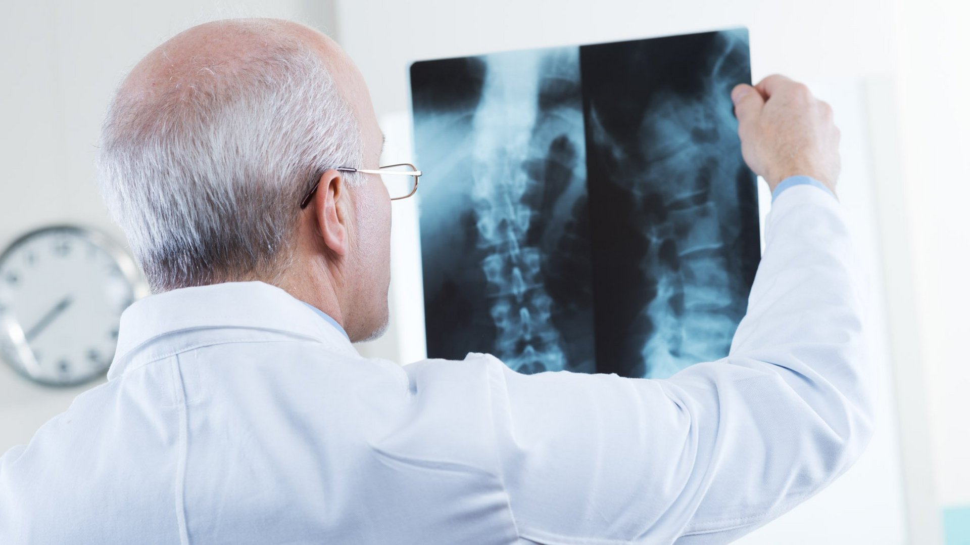 Rückenansicht eines Chirurgen, der Röntgenaufnahmen der Brust- und Halswirbelsäule studiert.