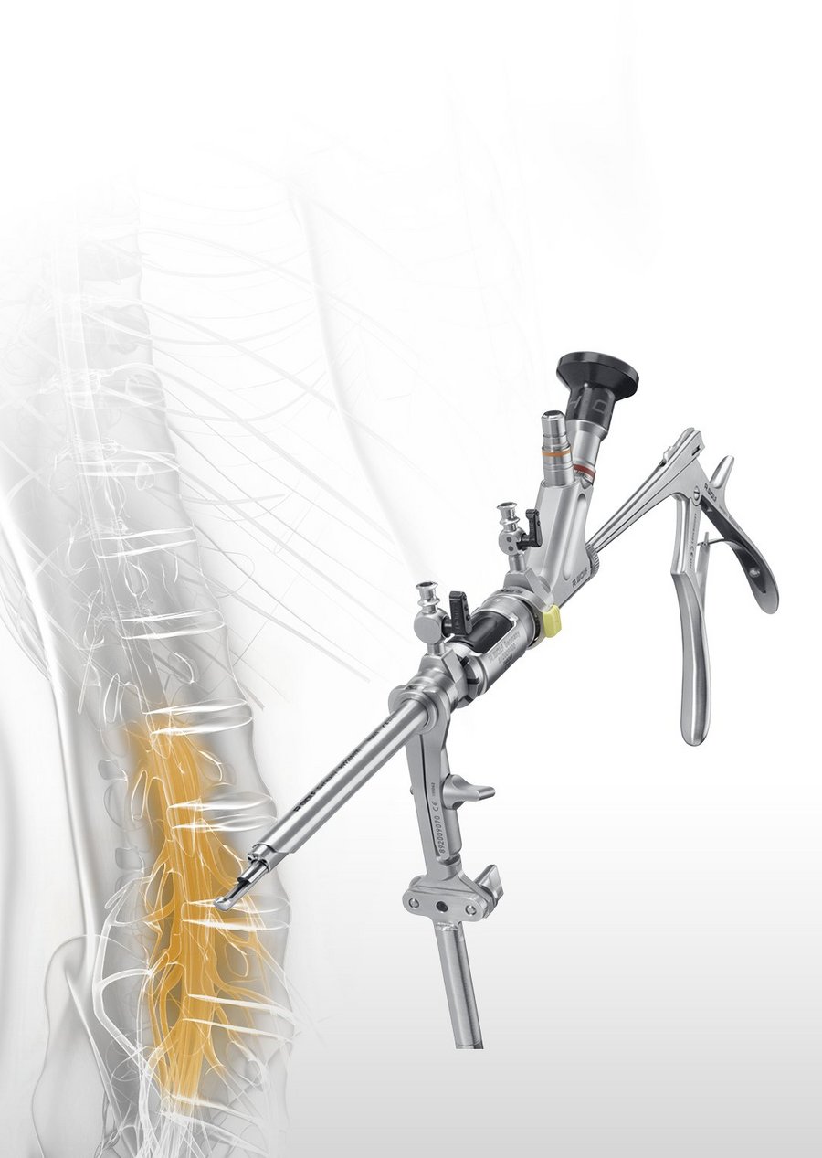 riwospine-vertebris-lumbar-interbody-fusion-system.png VERTEBRIS system for full-endoscopic lumbar interbody fusion with 5.5 mm working channel