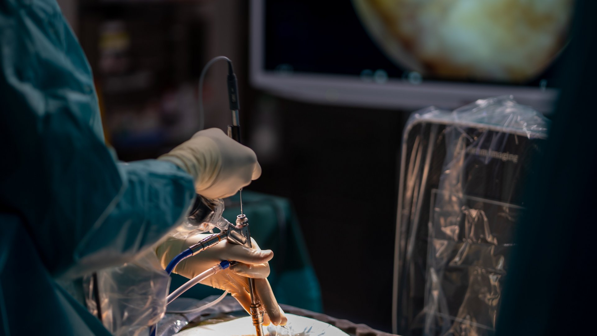 riwospine-insights-header-endoskopische-chirurgie.png Chirurg bei vollendoskopischer Wirbelsäulenoperation – RIWOspine klinische Innovation und Erfahrung